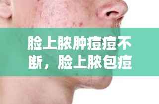 脸上脓肿痘痘不断,脸上脓包痘痘多久才好