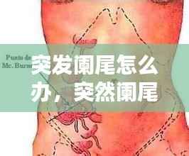 突发阑尾怎么办,突然阑尾疼什么原因
